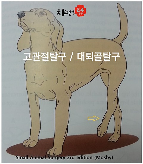 고관절탈구 / 대퇴골탈구 
